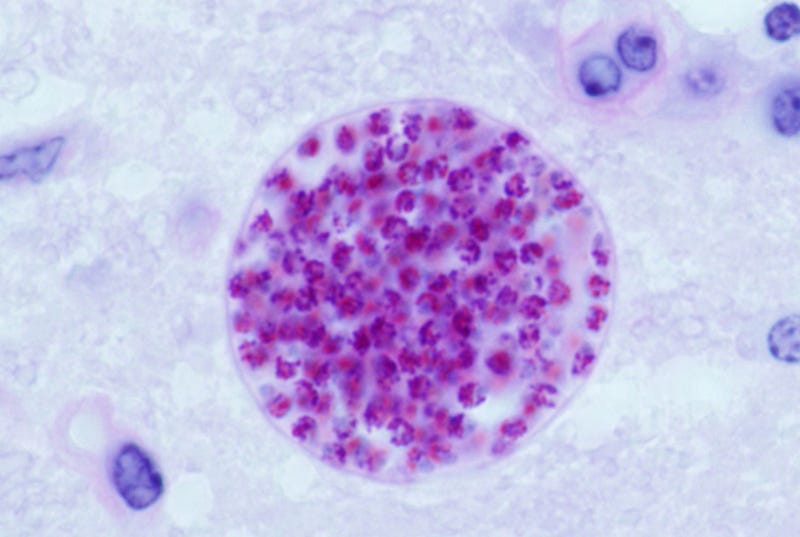 Toxoplasma gondii in a mouse brain